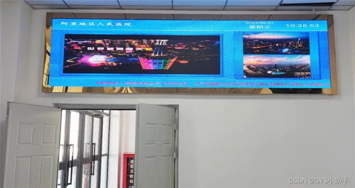 GVS視聲挺進(jìn)西藏，為阿里地區(qū)人民醫(yī)院打造全時(shí)高效智慧醫(yī)療體驗(yàn)